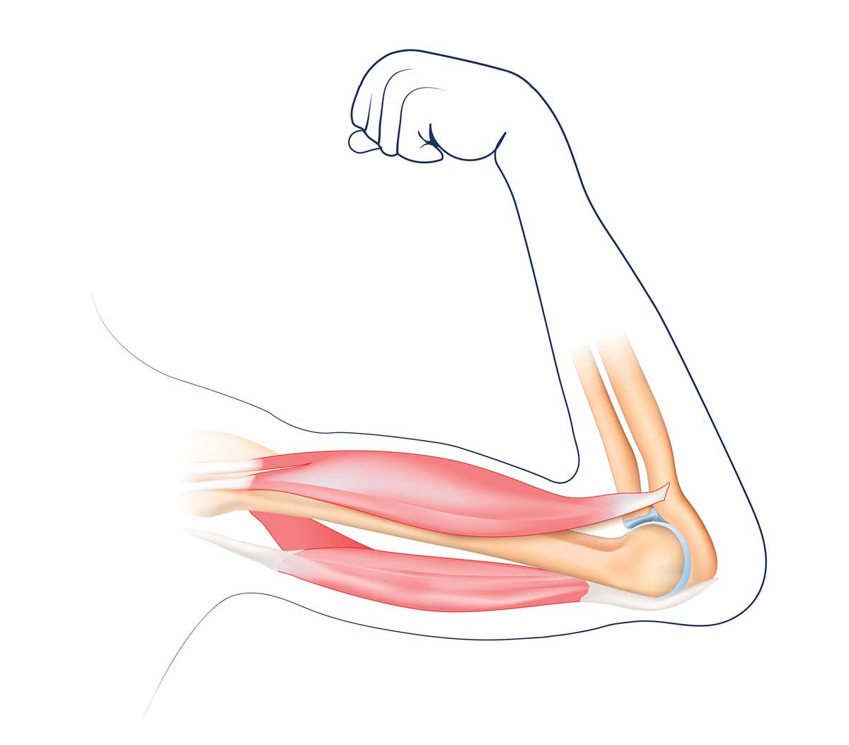 Sarcopenia: Pathology and Treatment