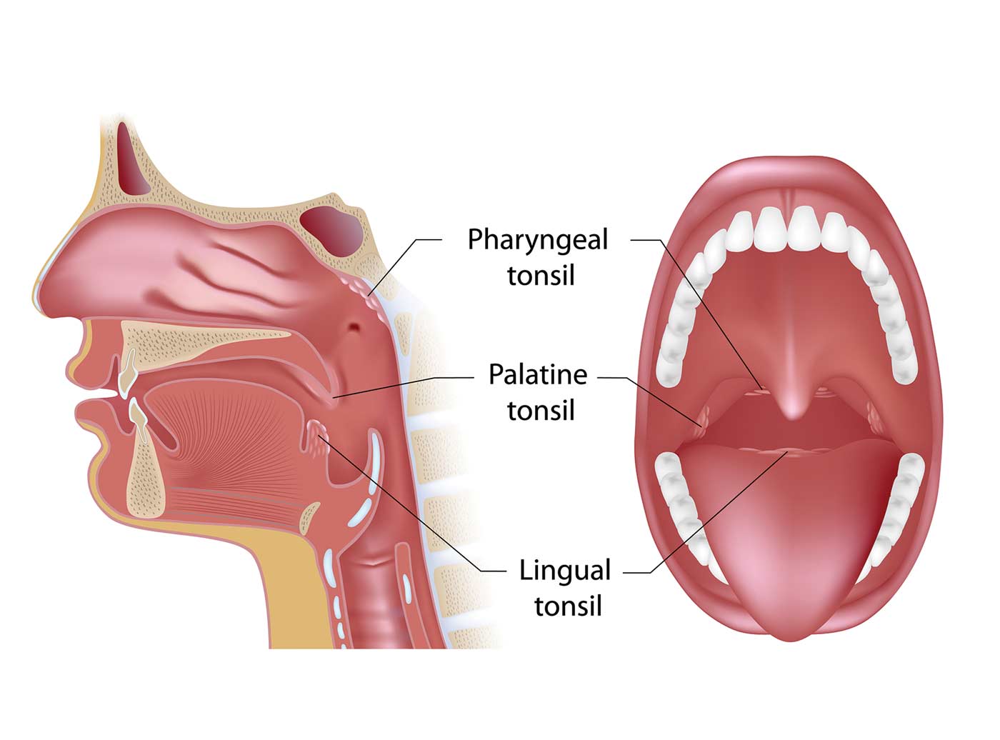 All About Tonsils